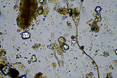 microorganisms and soil biology, with nematodes and fungi under the microscope. in a soil and...