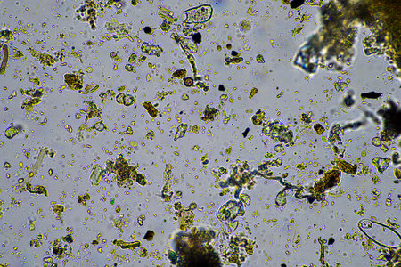 human parasite. gut intestinal infection disease. microorganism infection