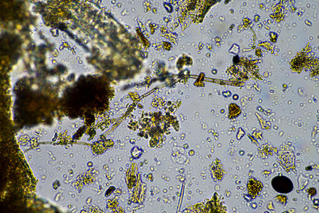 microorganisms and soil biology, with nematodes and fungi under the microscope. in a soil and...