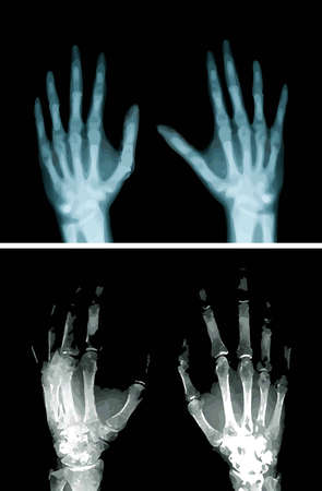Hands X-Rayのイラスト素材