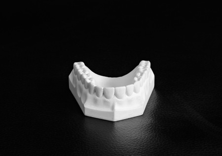 View of jaw model on black leather background.