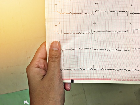 Hand hold ekg paperの素材