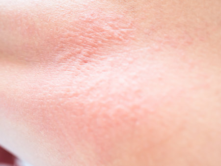 Woman with Urticaria on Skin Non-Lethal Type from Food and Air Poisoning Health,Medicine Body Care Disease Lilness Air,Infection Pain sickness Concept.の写真素材