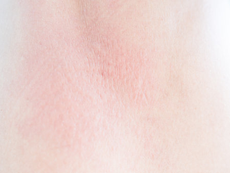 Woman with Urticaria on Skin ,Non-Lethal Type from Food and Air Poisoning Health,Medicine Body Care Disease Lilness Air,Infection Pain sickness.の写真素材