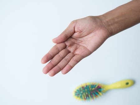 Hair Loss on Hand Women blur Cumb, Little Brown Hairloss Brushing Adult Problem Health Fashion Hairstyle Head Skin 

Dandruff Scalp Alopecia Female.の写真素材