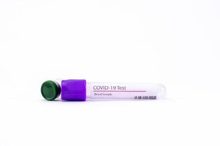 An empty COVID 19 blood test kit with a vial on white backgroundの写真素材