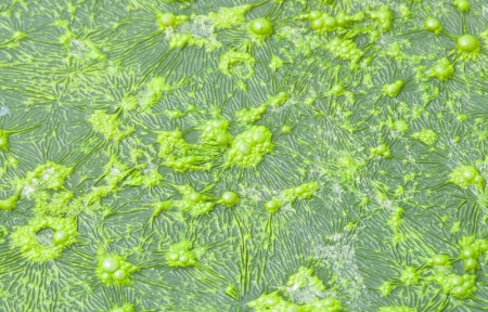 The polluted water were covered with film and algae 