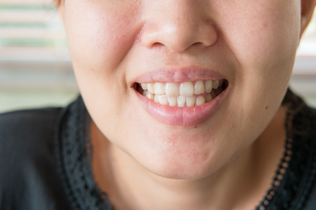 woman health teeth close upの写真素材