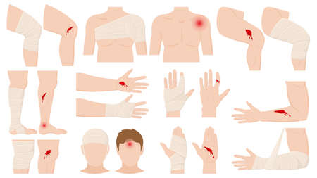 Cartoon physical injury, wound bandage application concept. Open and bandaged human body parts, treated wounds, fractures vector illustration. Human physical injury treatmentのイラスト素材