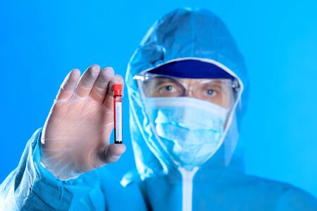 Worldwide coronavirus epidemic concept. Pandemic COVID-19, 2019-nCoV. Laboratory test strip for antibody or sars-cov-2 virus disease. In doctor handsの写真素材