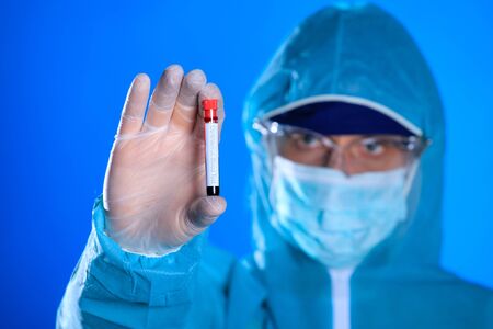 Coronavirus blood analysis concept. Test tube with a blood sample in doctor hand, close up view.の写真素材