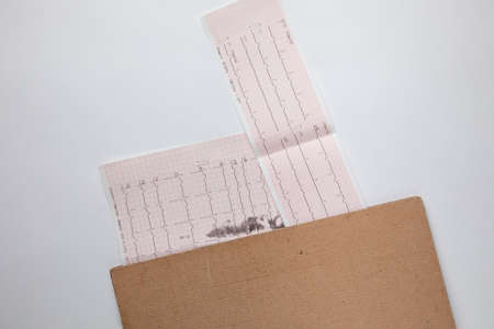 Medical records - EEG scan results - Human brain - brain wavesの写真素材