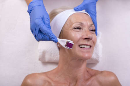 A portrait of a senior female getting an anti-aging treatment with derma rollerの写真素材