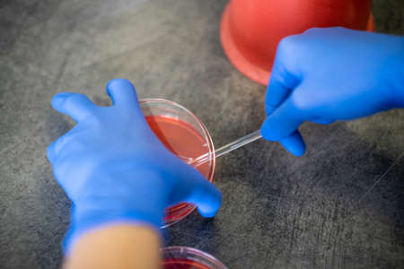 The nurse using test tubes for the new rapidly spreading Coronavirus