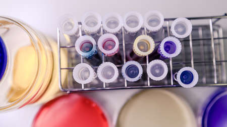 A high angle closeup shot of laboratory test tubes with different substances for coronavirus researchの写真素材