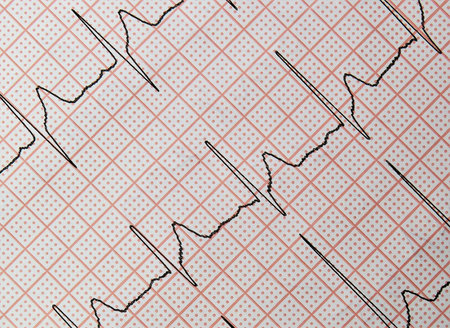 A closeup shot of the electrocardiogram of a heartの写真素材