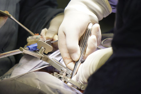 A closeup shot of doctors performing a spinal surgery under the lights - surgical concept