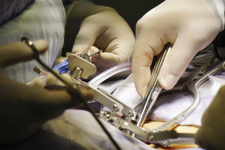 A closeup shot of doctors performing a spinal surgery under the lights - surgical concept