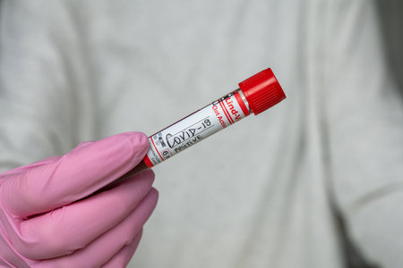 The Covid-19 test samples in the hands of a doctor