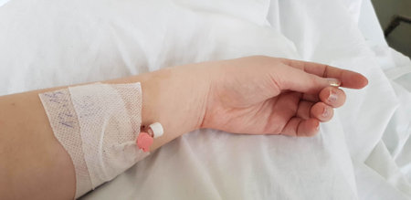 A shot of peripheral venous catheter in a young caucasian woman's arm