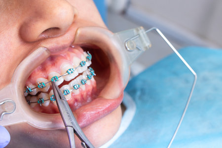 A high angle shot of a doctor fixing the patient's braces using dental equipmentの写真素材