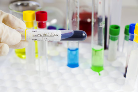 A closeup shot of a positive Staphylococci blood test full tube with other laboratory items in the...