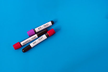 Three blood tubes for testing sexually transmitted diseases isolated on a blue backgroundの写真素材