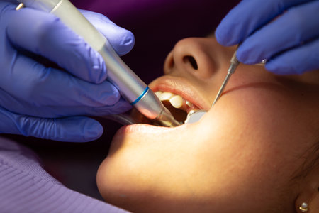 A closeup of a dentist doing dental treatment on a young Mexican girlの写真素材