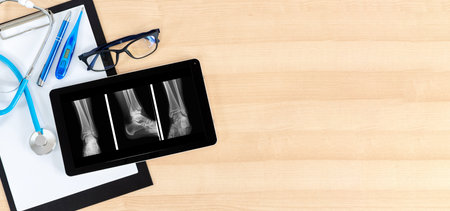 Clipboard, tablet, x-ray, thermometer and stethoscope on wooden desk. Medical diagnostics concept.