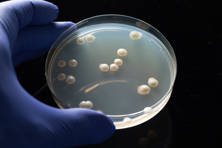 Closeup of the hand of a scientific researcher with blue glove holding a petri dish with bacterial...