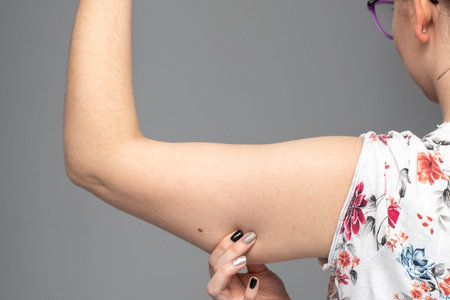 A closeup view of a Caucasian woman squeezing her arm showing saggy muscles and skin in her upper arm, commonly referred to as bingo wings.の写真素材