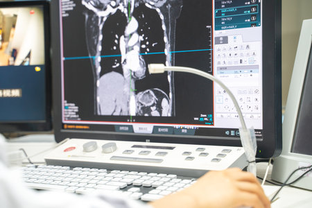 Chongqing, china-May  7, 2020:   Doctor analysis the test result from MRI Scaner on computer during Covid 19 pandemic.の写真素材