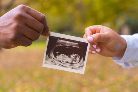 Hands of a couple celebrating pregnancy with an echo, pregnant session in a forestの写真素材