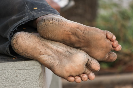 the Cracking heels of Old Man.の写真素材