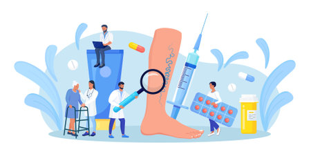 Vein Thrombosis and Varicose Treatment. Tiny Doctor with Magnifying Glass and Drugs around of Huge Foot with Diseased Veins. Elderly Woman came to Specialists for Examination Blood Vessels and Veins