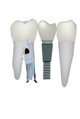Vector of a person cleaning teeth with a rag. The dental hygiene conceptのイラスト素材