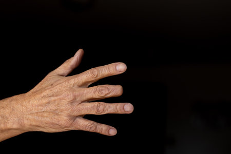 Elderly man right hand with amputated middle finger on black backgroundの写真素材