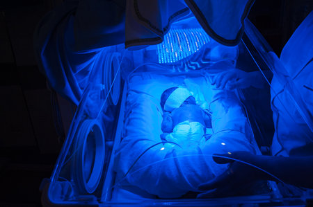 A closeup shot of a newborn baby in a hospital under a blue lightの写真素材