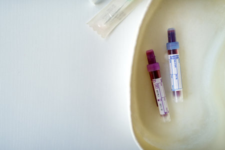 Horizontal view of samples of the patient's blood in closed tubes after collection.の写真素材