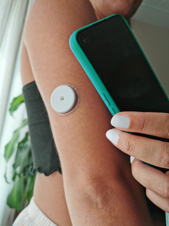 The Data collection for diabetes management with a mobile device such as a smartphone