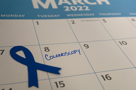 A calendar reminder about colonoscopy appointment in March, which is Colon Cancer Awareness Monthの写真素材
