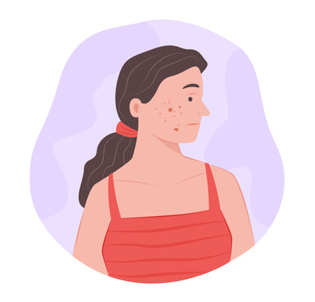 Woman with Acne and Scar on Face for Dermatological Symptom Concept Illustration Clip Artのイラスト素材