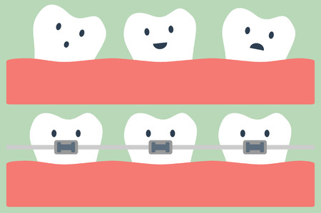 dental cartoon vector, teeth orthodonticsのイラスト素材