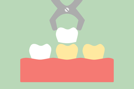 Teeth cartoon vector flat style for design, dental veneers - tooth whiteningのイラスト素材