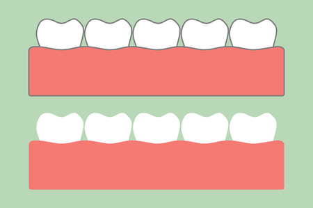 Tooth cartoon vector flat style for design, healthy teeth on gum for dental careのイラスト素材