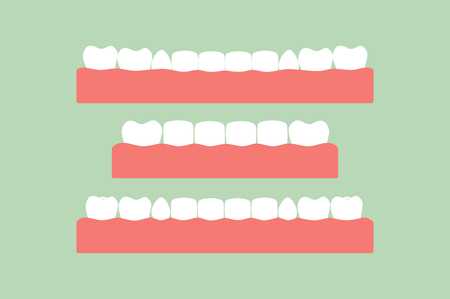 Tooth cartoon vector flat style for design - set of healthy teeth on gum, dental careのイラスト素材