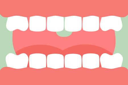 Tooth cartoon vector flat style for design - open mouth with healthy teeth and tongue, dental careのイラスト素材