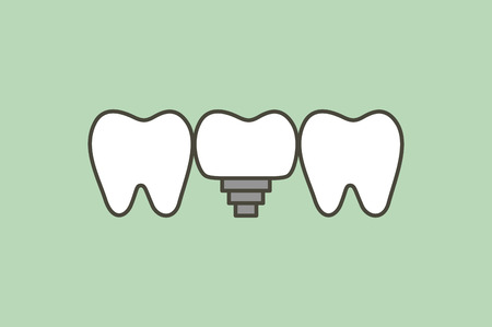 tooth implant, teeth change new root - dental cartoon  flat style cute character for designのイラスト素材