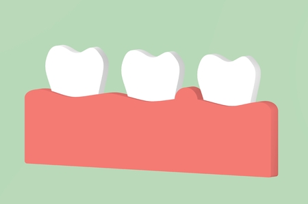 gingivitis or periodontal disease, inflammation of the gum tissue around the teeth - dental cartoon 3d render flat style cute character for designの写真素材