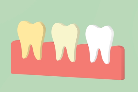 yellow to white tooth, teeth whitening concept - dental cartoon 3d render flat style cute character for designの写真素材